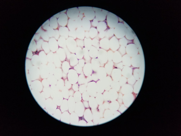 Adipose Connective Slides - Adipose Connective 07 400X